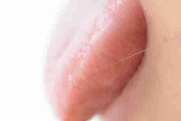 为什么早上醒来后，舌苔总是厚腻发臭，和哪些因素有关？